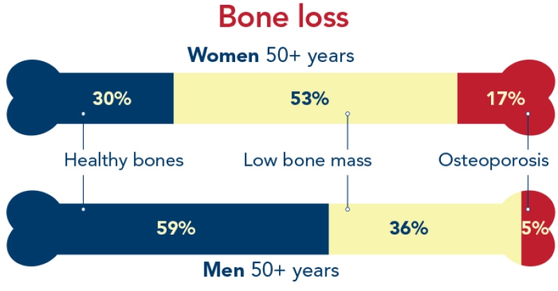 bone loss infographic